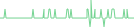 Sparkline Img